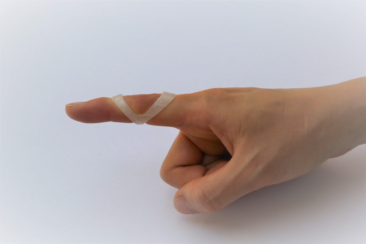 Duradigit 3D printed finger ring splint Durathumb